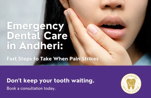 Teeth Whitening Treatment in Andheri East