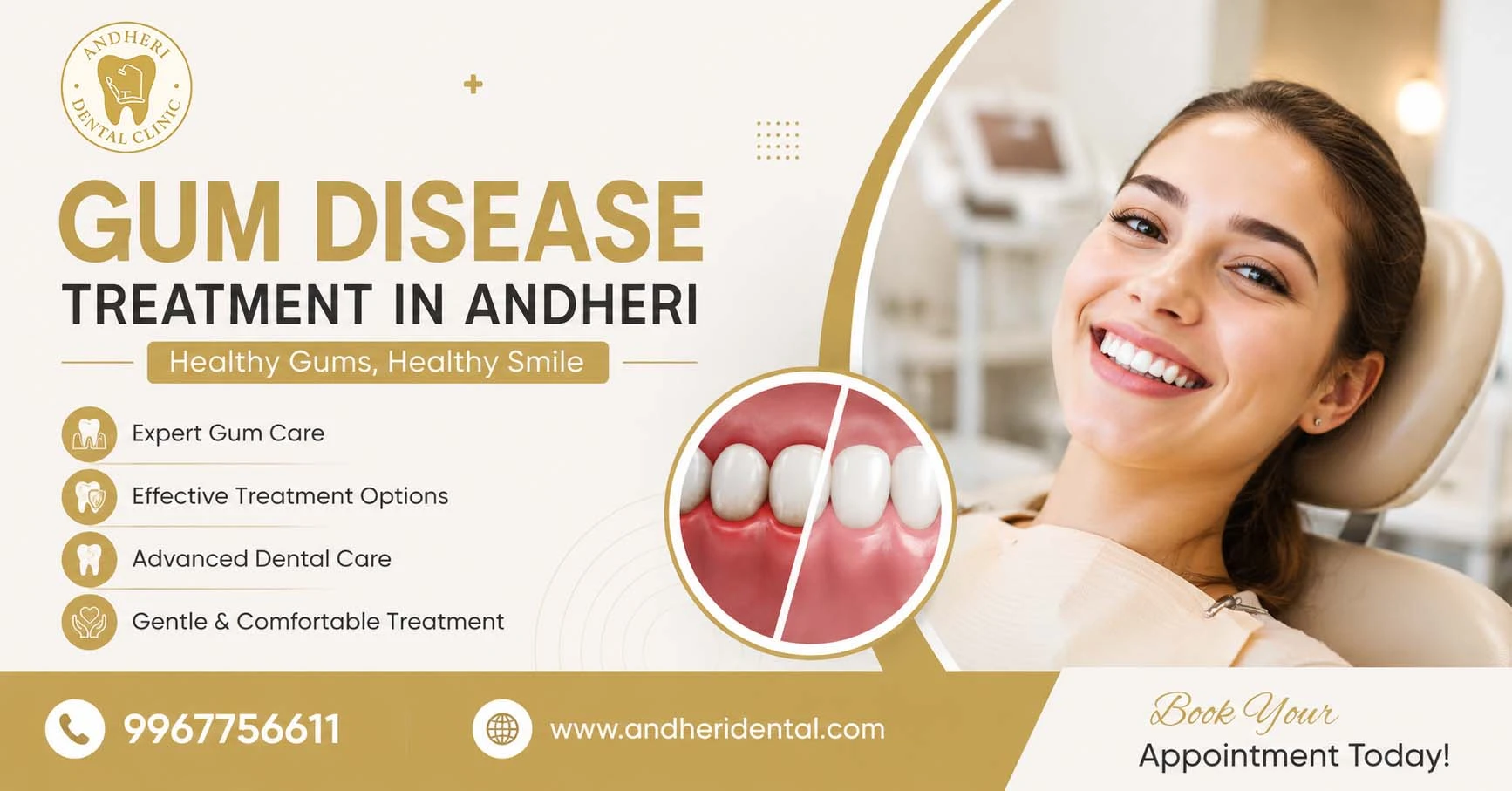 All You Need to Know About Gum Disease & Treatment Options
