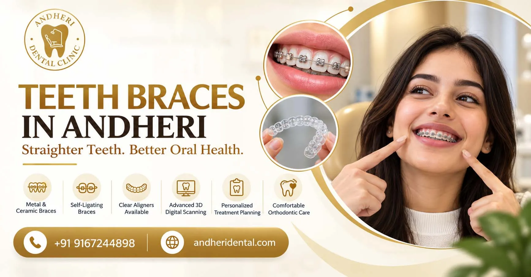 Teeth Braces for Straighter Teeth & Better Oral Health
