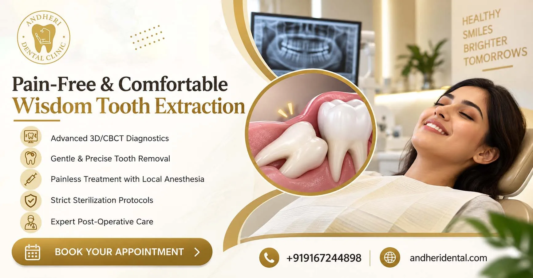Wisdom Tooth Removal in Andheri Mumbai